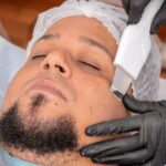 chemical peel treatment