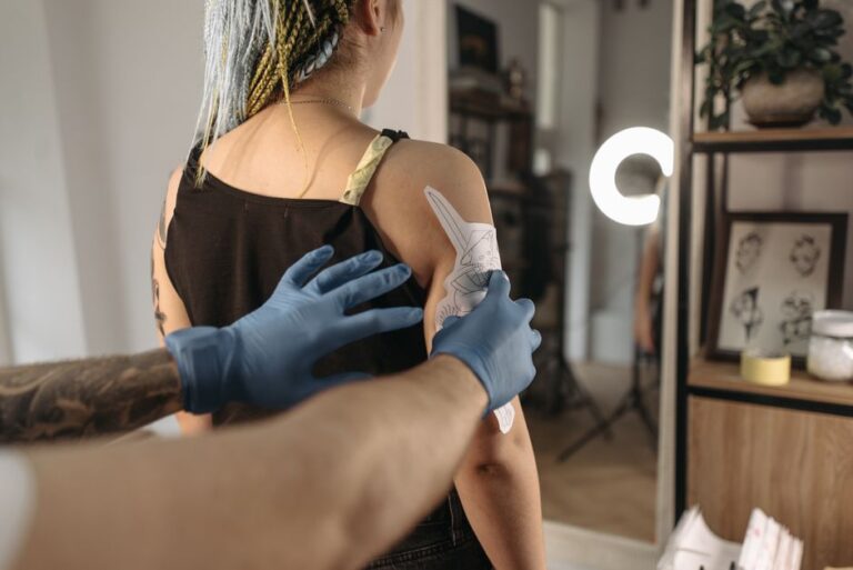 eliminación tatuaje láser